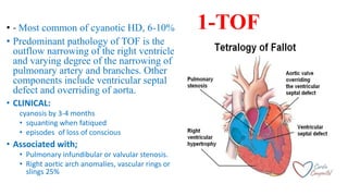 Cyanotic heart diseases | PPTX