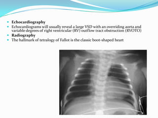  Echocardiography
 Echocardiograms will usually reveal a large VSD with an overriding aorta and
variable degrees of right ventricular (RV) outflow tract obstruction (RVOTO)
 Radiography
 The hallmark of tetralogy of Fallot is the classic boot-shaped heart

 