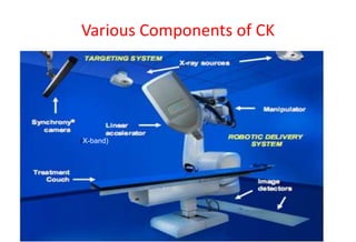 Cyberknife | PPT