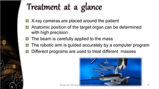 Cyber knife .Shabnam.pptx. Introduction of radiosurgery | PPTX