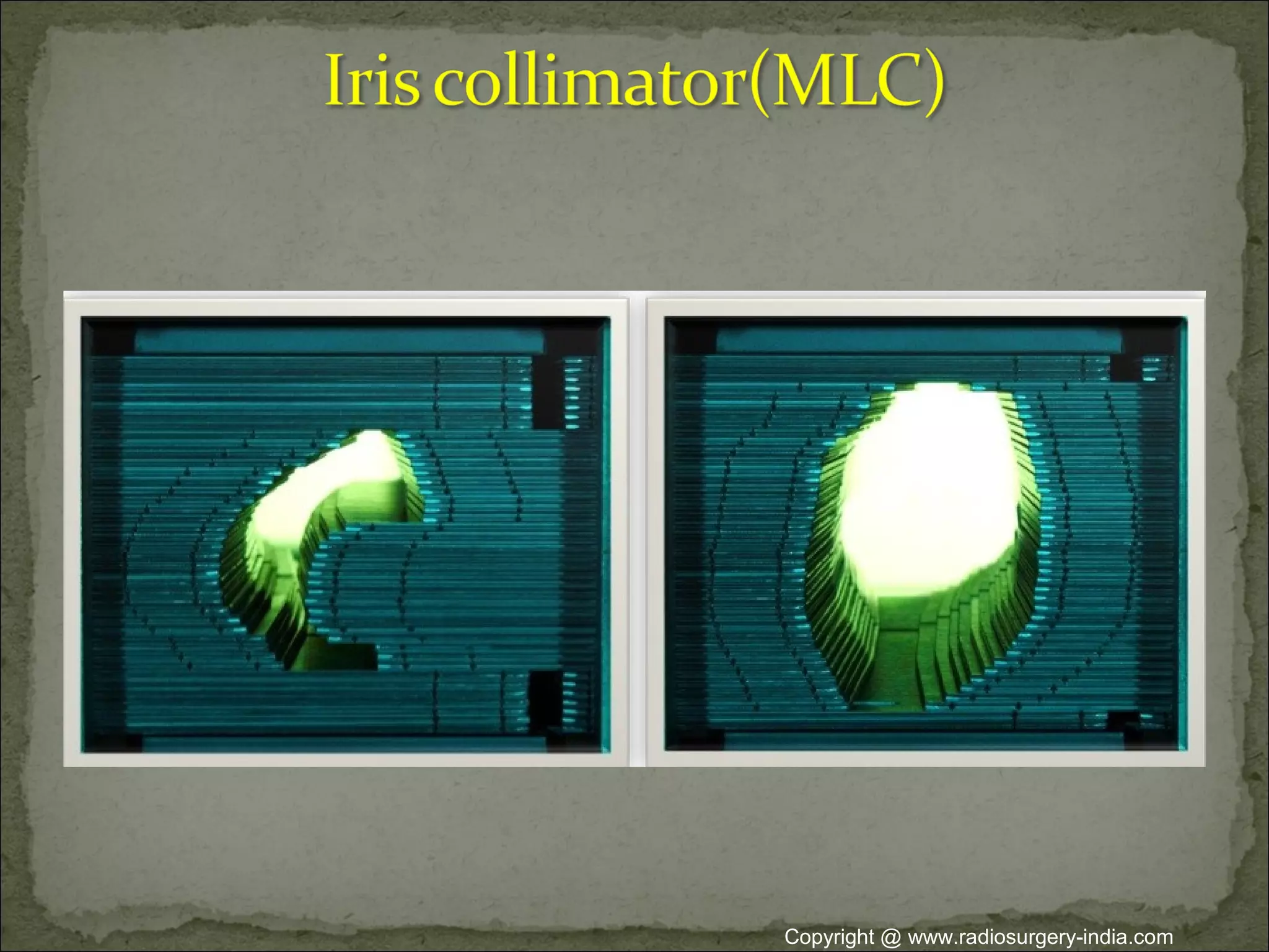 Copyright @ www.radiosurgery-india.com
 