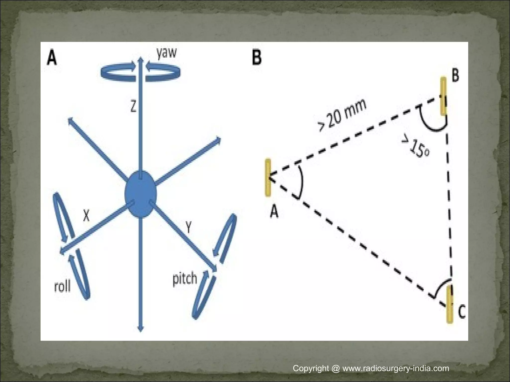 Copyright @ www.radiosurgery-india.com
 
