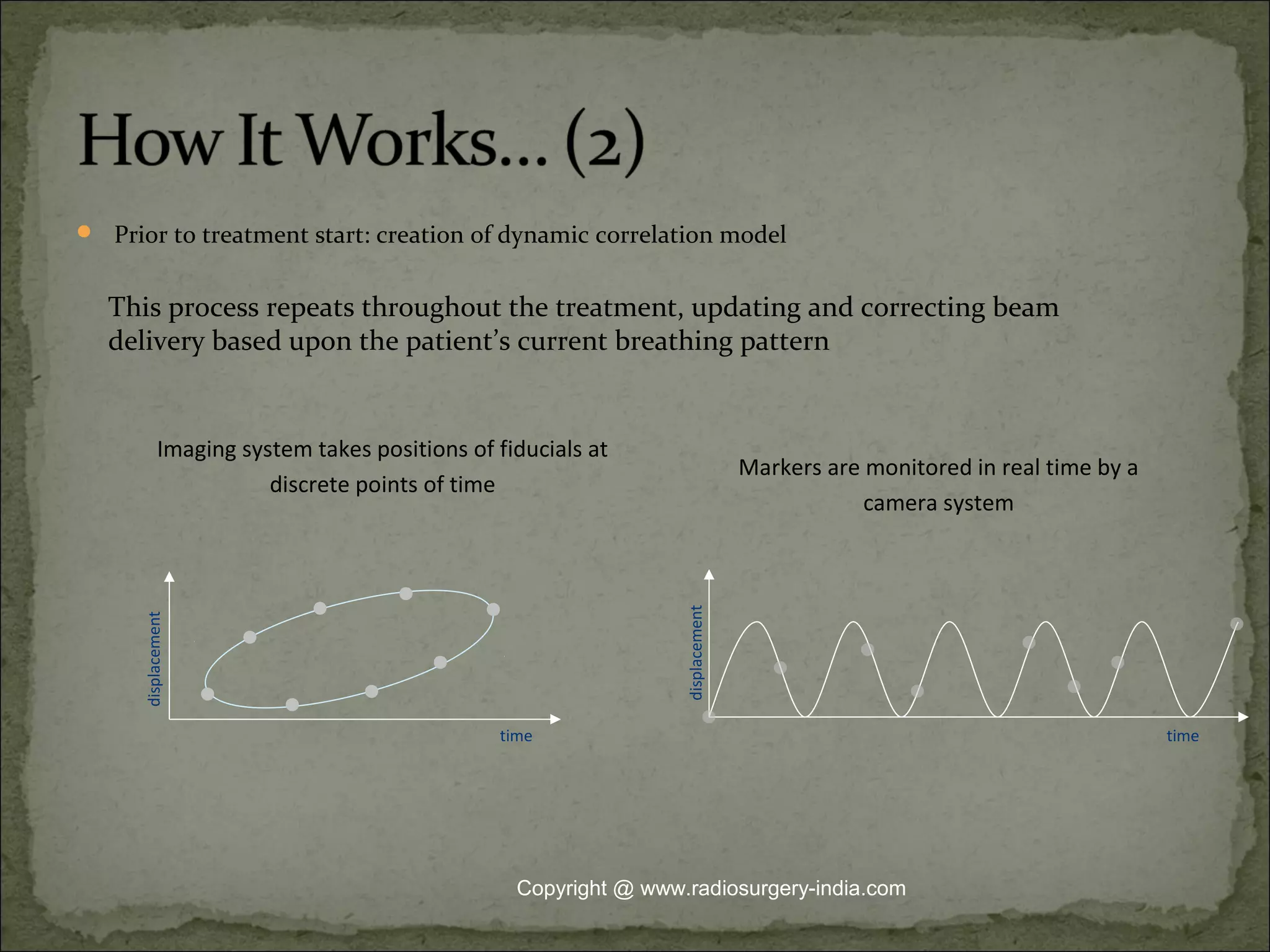  Prior to treatment start: creation of dynamic correlation model
Markers are monitored in real time by a
camera system
Imaging system takes positions of fiducials at
discrete points of time
time
displacement
displacement
time
This process repeats throughout the treatment, updating and correcting beam
delivery based upon the patient’s current breathing pattern
Copyright @ www.radiosurgery-india.com
 