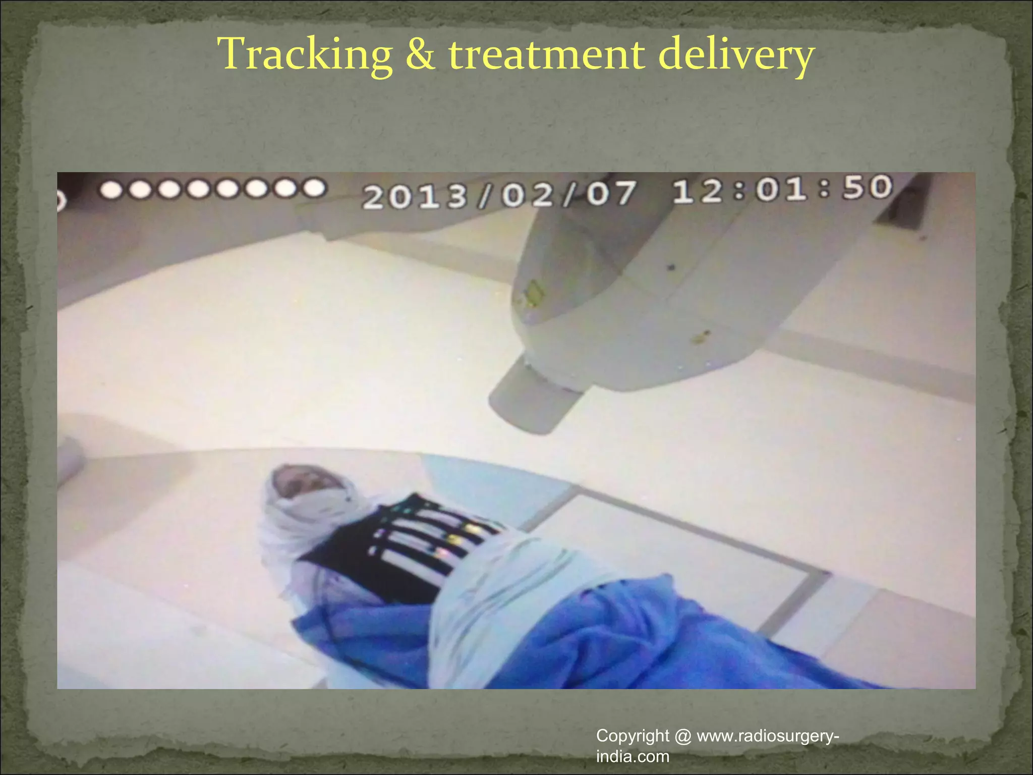 Tracking & treatment delivery
Copyright @ www.radiosurgery-
india.com
 
