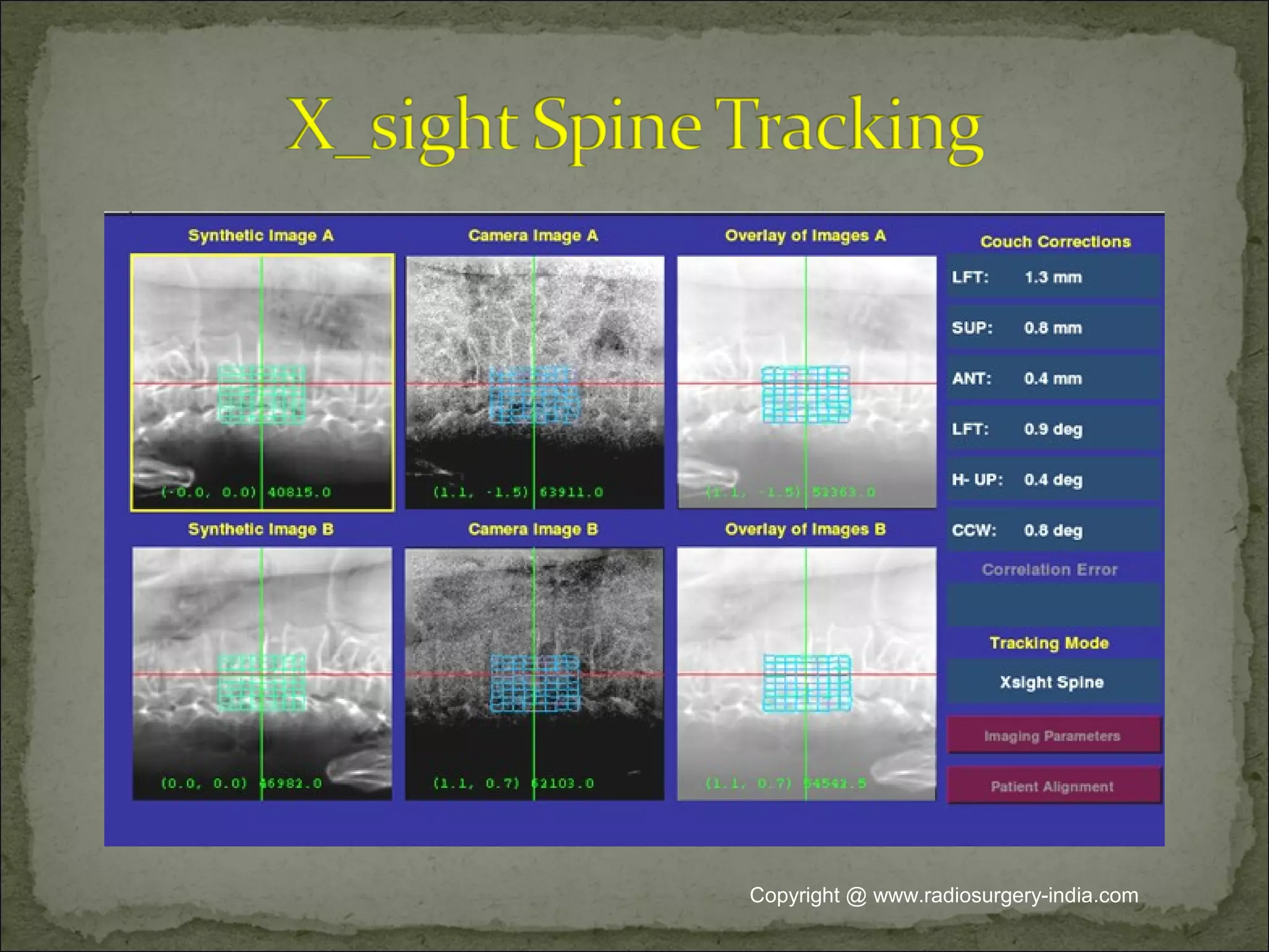 Copyright @ www.radiosurgery-india.com
 