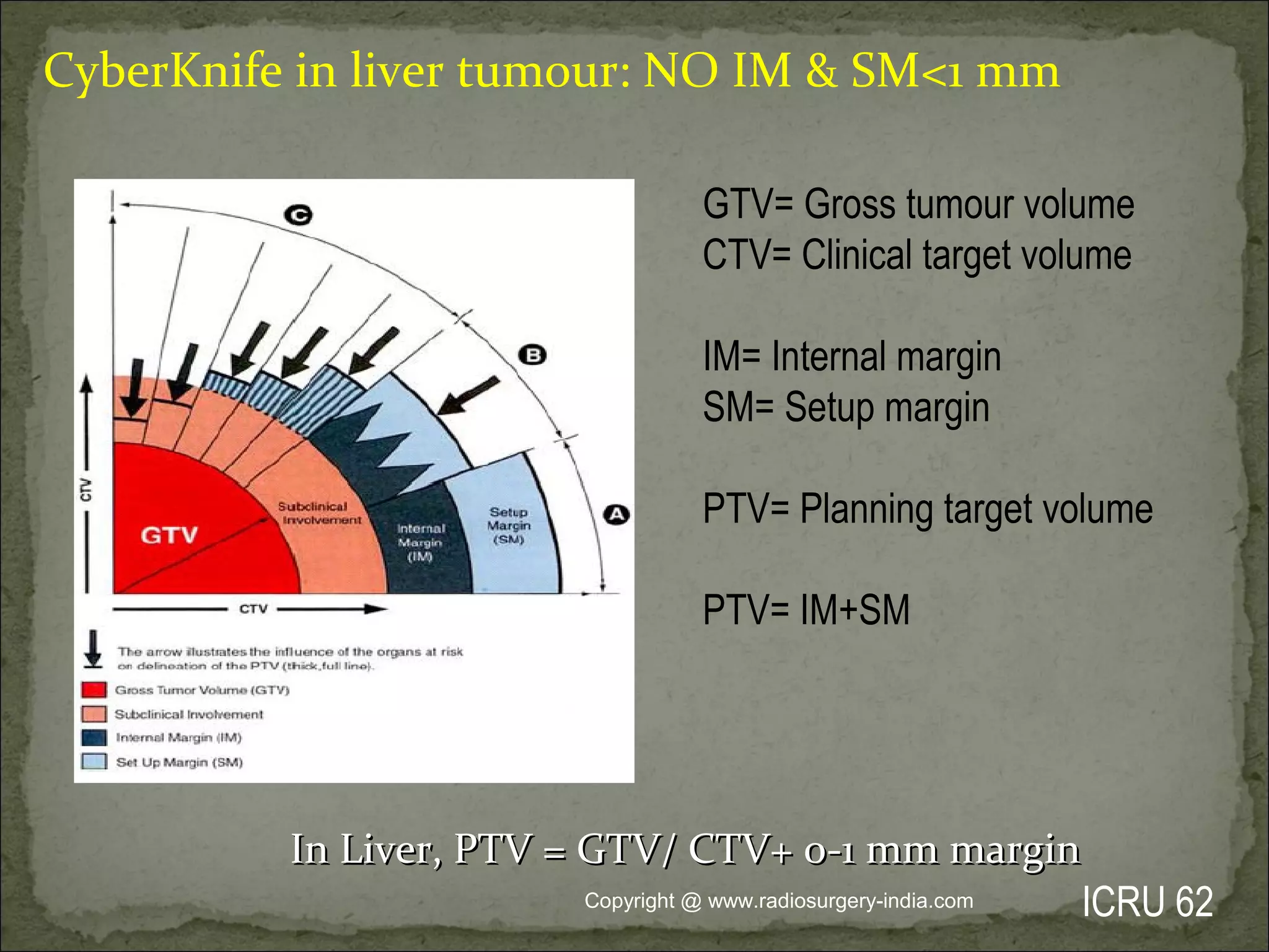 GTV= Gross tumour volume
CTV= Clinical target volume
IM= Internal margin
SM= Setup margin
PTV= Planning target volume
PTV= IM+SM
ICRU 62
CyberKnife in liver tumour: NO IM & SM<1 mm
In Liver, PTV = GTV/ CTV+ 0-1 mm marginIn Liver, PTV = GTV/ CTV+ 0-1 mm margin
Copyright @ www.radiosurgery-india.com
 