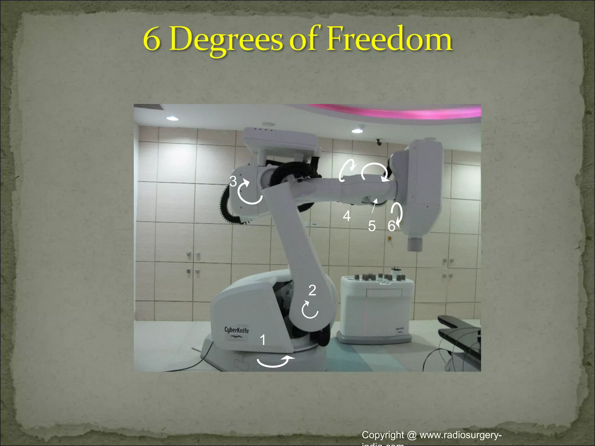 5
1
2
3
4
65
Copyright @ www.radiosurgery-
 