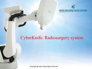 CyberKnife: Radiosurgery system
Copyright @ www.radiosurgery-india.com
 