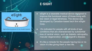 ● eSight is a wearable medical device designed to
improve the functional vision of those living with
low vision or legal blindness. The device was
developed by Canadian-based tech firm eSight
Corp.
● It’s indicated for people with all kinds of eye
conditions that are characterized by substantial
loss of central vision, such as diabetic retinopathy,
macular degeneration, and Stargardt’s disease.
● It’s like a miracle for the people having low or no
vision it’s like giving them a new life.
E-SIGHT
 