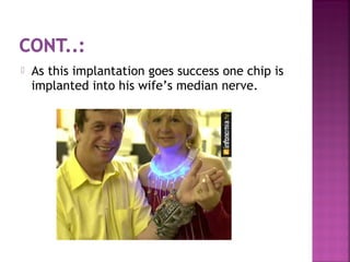  As this implantation goes success one chip is
implanted into his wife’s median nerve.
 