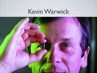 Kevin Warwick
 
