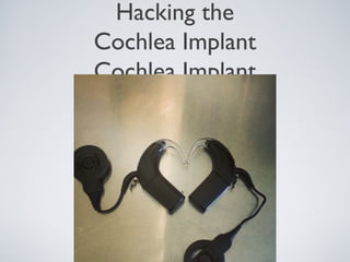 Hacking the
Cochlea Implant
Cochlea Implant
 