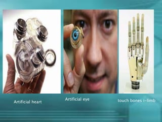 Artificial heart touch bones i-limbArtificial eye
 