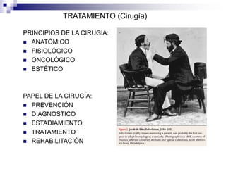 PRINCIPIOS DE LA CIRUGÍA:
 ANATÓMICO
 FISIOLÓGICO
 ONCOLÓGICO
 ESTÉTICO
PAPEL DE LA CIRUGÍA:
 PREVENCIÓN
 DIAGNOSTICO
 ESTADIAMIENTO
 TRATAMIENTO
 REHABILITACIÓN
TRATAMIENTO (Cirugía)
 