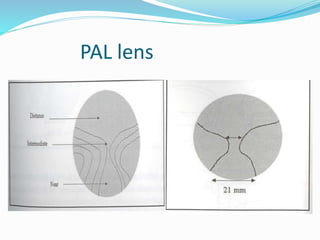PAL lens
 