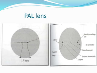 PAL lens
 
