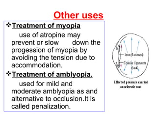 Other uses
Treatment of myopia
use of atropine may
prevent or slow down the
progession of myopia by
avoiding the tension due to
accommodation.
Treatment of amblyopia.
used for mild and
moderate amblyopia as and
alternative to occlusion.It is
called penalization.
 