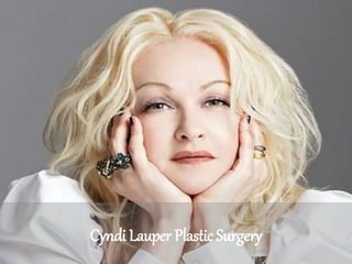 Cyndi Lauper Plastic Surgery
 