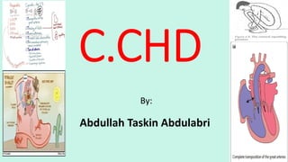C.CHD
By:
Abdullah Taskin Abdulabri
 