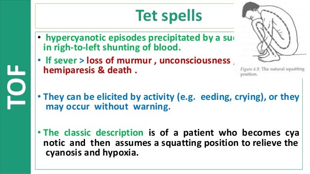 tet spell