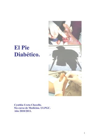 El Pie
Diabético.




Cynthia Ureta Checcllo.
5to curso de Medicina. ULPGC.
Año 2010/2011.




                                1
 