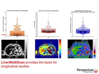 LiverMultiScan provides the basis for
longitudinal studies
 