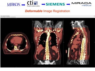 Deformable Image Registration
 