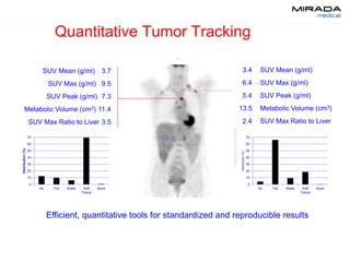 Quantitative Tumor Tracking
0
10
20
30
40
50
60
70
Air Fat Water Soft
Tissue
Bone
Distribution(%)
0
10
20
30
40
50
60
70
Air Fat Water Soft
Tissue
Bone
Distribution(%)
Efficient, quantitative tools for standardized and reproducible results
3.4 SUV Mean (g/ml)
6.4 SUV Max (g/ml)
5.4 SUV Peak (g/ml)
13.5 Metabolic Volume (cm3)
2.4 SUV Max Ratio to Liver
3.7SUV Mean (g/ml)
9.5SUV Max (g/ml)
7.3SUV Peak (g/ml)
11.4Metabolic Volume (cm3)
3.5SUV Max Ratio to Liver
 