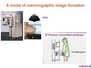 A model of mammographic image formation
tube
150N
 