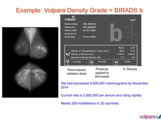Example: Volpara Density Grade = BIRADS b
We had processed 4,000,000 mammograms by November
2014
Current rate is 3,000,000 per annum and rising rapidly
Nearly 200 installations in 32 countries
% DensityPressure
applied to
the breast
Personalised
radiation dose
 
