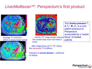 Average T1 is 817ms –
which is reassuringly normal
… but the T2* image shows massive
iron content (too much red meat or
wine)
LiverMultiscan™: Perspectum’s first product
… after image fusion of T1, T2*, Dixon,
the corrected T1 is 959ms,
indicative of severe disease – confirmed
on biopsy.
This fusion process T1
& T2*  cT1 is a core
patent exclusive to
Perspectum,
surrounded by a “picket
fence” of related
patents
 