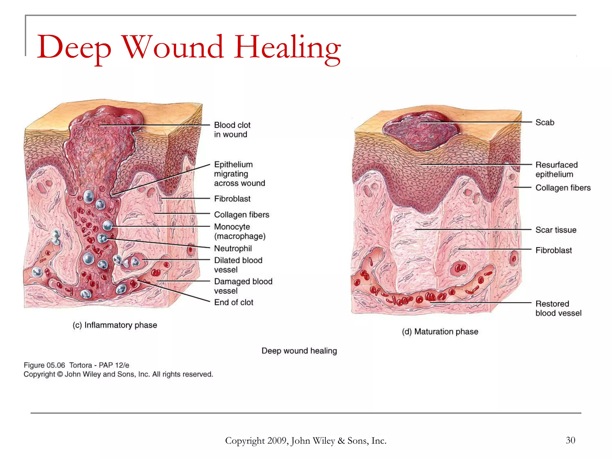 Copyright 2009, John Wiley & Sons, Inc. 30
Deep Wound Healing
 