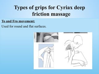 To and Fro movement:
Used for round and flat surfaces.
To and Fro movement:
Used for round and flat surfaces.
Types of grips for Cyriax deep
friction massage
 