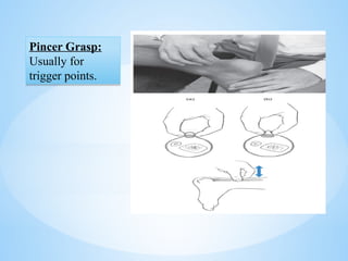 Pincer Grasp:
Usually for
trigger points.
Pincer Grasp:
Usually for
trigger points.
 