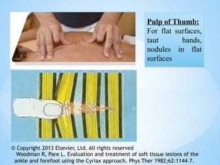 Pulp of Thumb:
For flat surfaces,
taut bands,
nodules in flat
surfaces
Pulp of Thumb:
For flat surfaces,
taut bands,
nodules in flat
surfaces
© Copyright 2013 Elsevier, Ltd. All rights reserved
Woodman R, Pare L. Evaluation and treatment of soft tissue lesions of the
ankle and forefoot using the Cyriax approach. Phys Ther 1982;62:1144–7.
 