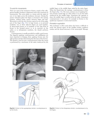 C H A P T E R 5Principles of treatment
89
middle finger or the middle finger aided by the index finger.
When the thumb does the massage, counterpressure is from
the fingers (Fig. 5.3). The most common way of applying fric-
tion around a round edge on a flat surface is to use the index
reinforced by the middle finger. Sometimes the opposite is
done: the middle finger is reinforced by the index. Sometimes
counterpressure is not given, for example in friction to the
quadriceps expansion or intercostal muscles.
Pronation–supination
This technique is often used where the lesion is difficult to
reach: the anterior aspect of the Achilles tendon, popliteus
tendon and the dorsal interossei of the metacarpals. Massage
To-and-fro movements
These are used in the treatment of dense, round or flat colla-
genous bundles (tendons or ligaments) and in the treatment of
tenosynovitis. The active phase is a sweep with the tip(s) of
one or two digits across the tendinous structure. During the
passive relaxation phase the finger is returned to the starting
position, without losing contact between finger and skin.
Movement is with the arm; friction is given by use of the pulpy
part of the finger (Fig. 5.2). In large lesions, as in peroneal
tendinitis, two or three adjacent fingers are used together.
In deep-seated lesions as in tendinitis of the long head of
biceps in the bicipital groove or at its insertion on the
radius or in infraspinatus tendinitis, the thumb performs
friction.
Counterpressure is usually provided to enable a good sweep.
The finger(s) applying counterpressure and stabilization are
most important in bringing those applying friction into the
right position and also determining the direction of the friction.
The thumb is used (to give counterpressure) when the sweep
is performed by a movement of the index reinforced by the
Fig 5.2 • Friction to the supraspinatus tendon: counterpressure is
by the thumb.
Fig 5.3 • Friction to the infraspinatus tendon: counterpressure is by
the fingers.
 