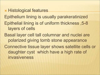  Histological features 
Epithelium lining is usually parakeratinized 
Epithelial lining is of uniform thickness ,5-8 
layers of cells 
Basal layer cell tall columnar and nuclei are 
polarized giving tomb stone appearance 
Connective tissue layer shows satellite cells or 
daughter cyst which have a high rate of 
invasiveness 
 