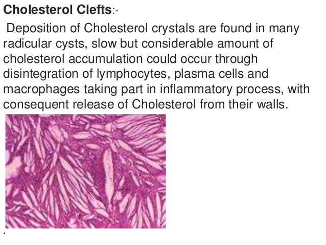 Cyst
