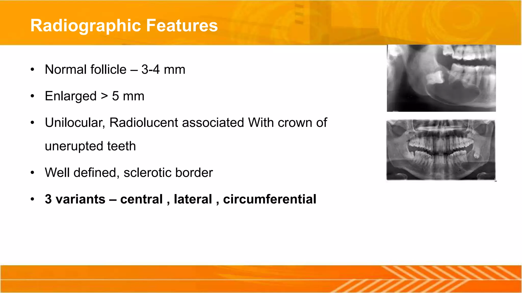 Radiographic Features
• Normal follicle – 3-4 mm
• Enlarged > 5 mm
• Unilocular, Radiolucent associated With crown of
unerupted teeth
• Well defined, sclerotic border
• 3 variants – central , lateral , circumferential
 