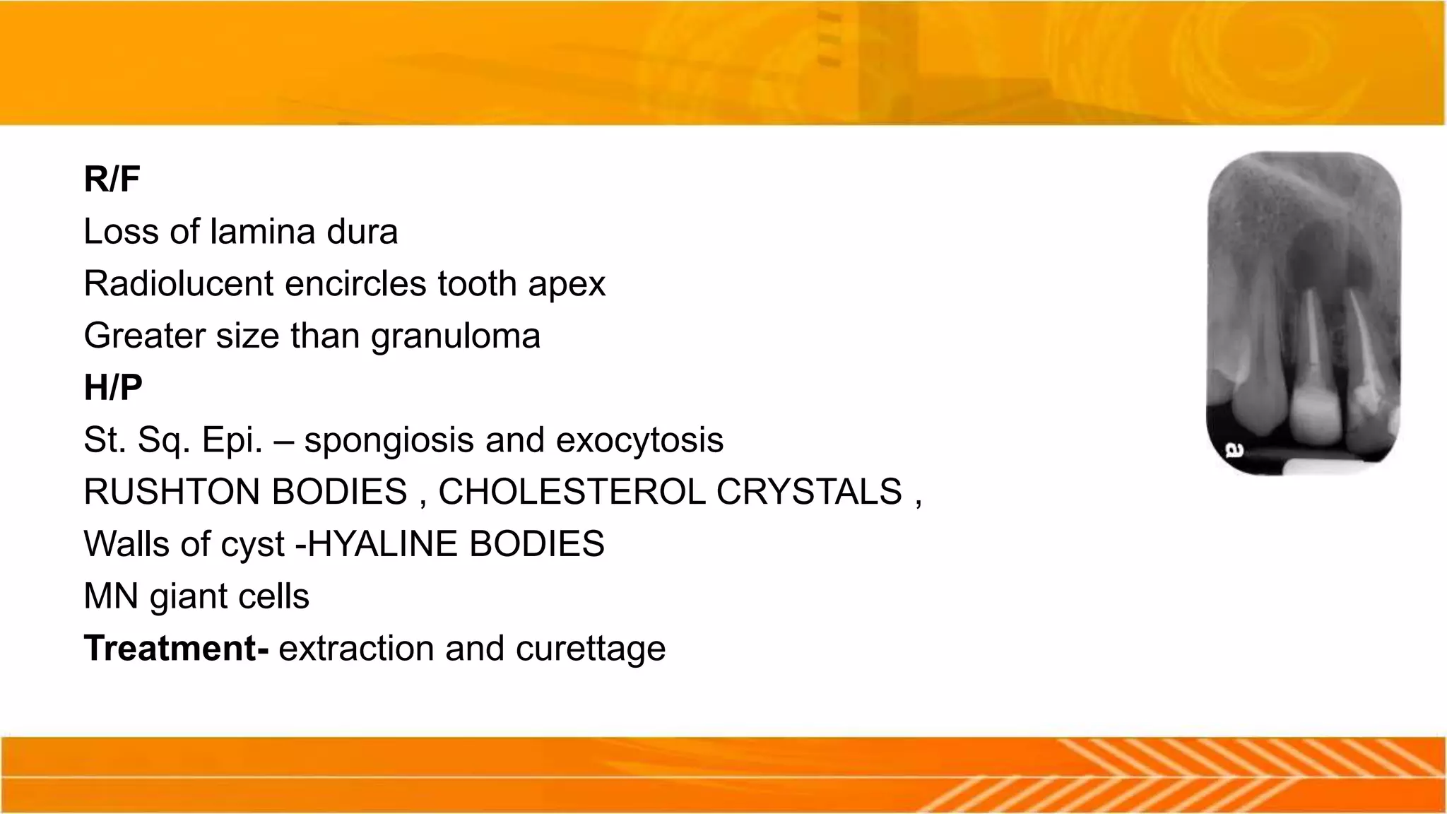 R/F
Loss of lamina dura
Radiolucent encircles tooth apex
Greater size than granuloma
H/P
St. Sq. Epi. – spongiosis and exocytosis
RUSHTON BODIES , CHOLESTEROL CRYSTALS ,
Walls of cyst -HYALINE BODIES
MN giant cells
Treatment- extraction and curettage
 
