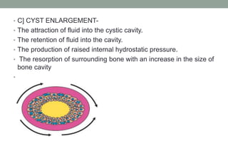 Cysts Expression Cyst of oral and maxillofacial regions | PPTX
