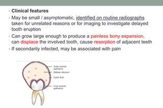 Mri Infected Tooth Cyst of oral and maxillofacial regions | PPTX