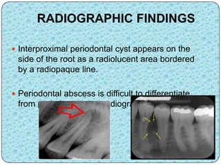 RADIOGRAPHIC FINDINGS
 Interproximal periodontal cyst appears on the
side of the root as a radiolucent area bordered
by a radiopaque line.
 Periodontal abscess is difficult to differentiate
from periodontal cyst, radiographically
 