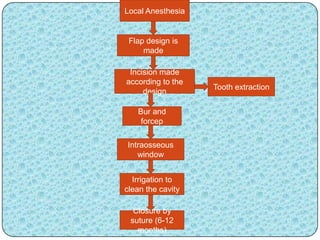 Local Anesthesia
Flap design is
made
Incision made
according to the
design
Tooth extraction
Bur and
forcep
Intraosseous
window
Irrigation to
clean the cavity
Closure by
suture (6-12
months)
 