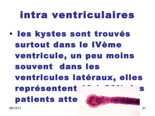 intra ventriculaires les kystes sont trouvés surtout dans le IVème ventricule, un peu moins souvent  dans les ventricules latéraux, elles représentent 10 à 20% des patients atteints 