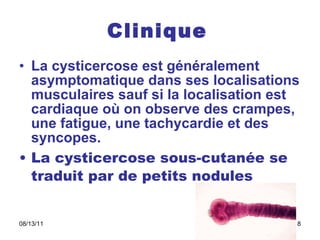 Clinique   La cysticercose est généralement asymptomatique dans ses localisations musculaires sauf si la localisation est cardiaque où on observe des crampes, une fatigue, une tachycardie et des syncopes.  La cysticercose sous-cutanée se traduit par de petits nodules 
