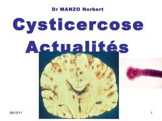 Dr MANZO Norbert   Cysticercose Actualités 