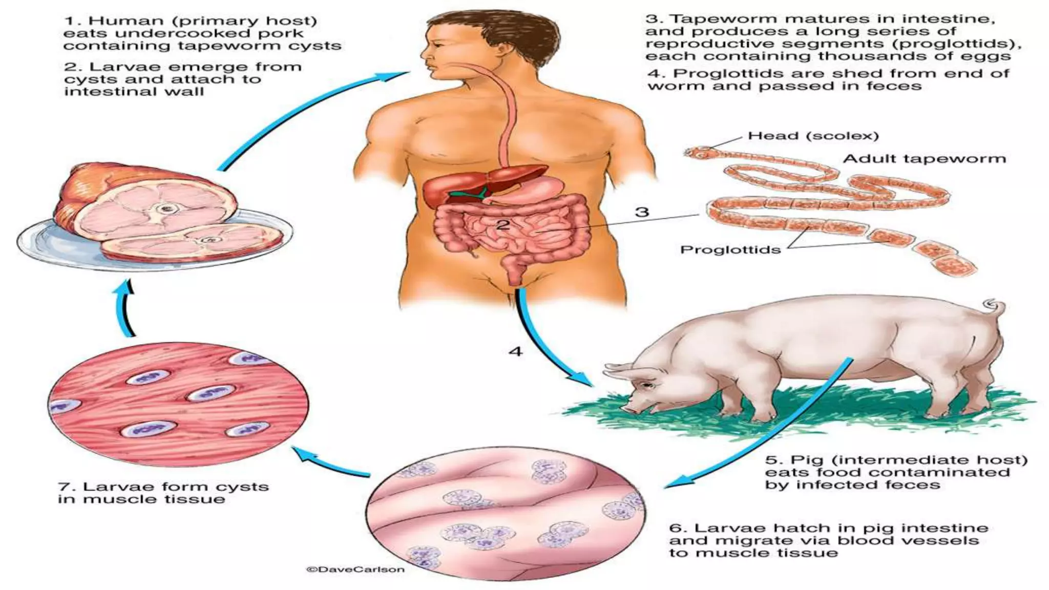 Cysticercosis -types symptoms| management |prevention (medical notes ...