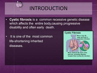 INTRODUCTION
• Cystic fibrosis is a common recessive genetic disease
which affects the entire body,causing progressive
disability and often early death.
• It is one of the most common
life-shortening inherited
diseases.
 