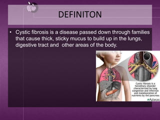 DEFINITON
• Cystic fibrosis is a disease passed down through families
that cause thick, sticky mucus to build up in the lungs,
digestive tract and other areas of the body.
 